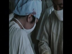 SYND 14-06-72  ACUPUNCTURE USED IN SURGICAL OPERATION News Clip