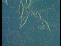 CU Microsporum canis, Ringworm fungus, fungal infection of the skin, blue background changes to red Stock Footage