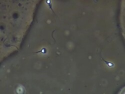 Human sperm swimming, close up, Phase contrast Stock Footage