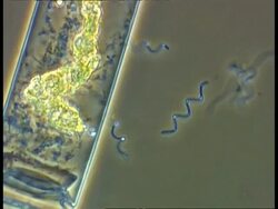 Moving across clear freshwater sample to view Spirochaeta bacteria moving around algal cells, Phase Contrast Stock Footage