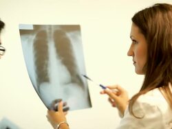 Doctors consults over an X-ray Images Stock Footage