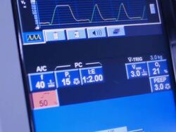 Ventilator setting Stock Footage