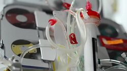 dialysis machine Stock Footage