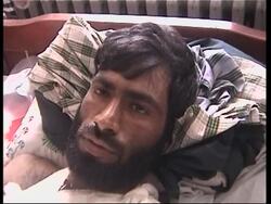 Injured in hospital, amid reports of 51civilian deaths in recent fighting News Clip