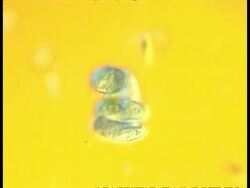 CU microscopic view of Ciliate protozoans, group, possibly pre conjugation Stock Footage