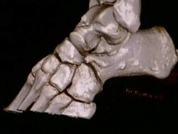 CU CT scan of human ankle / Vermont, USA Stock Footage