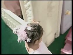 Girl known as the "little mermaid" has her first day at ballet school News Clip