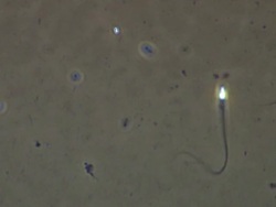 Single Human sperm swimming, Phase contrast Stock Footage