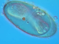 F. hepatica (Liver Fluke) egg measuring 140 by 80 micrometres. The ciliated larva prior to hatching is seen to be pushing hard in order to emerge through the operculum as a miracidium larva Stock Footage