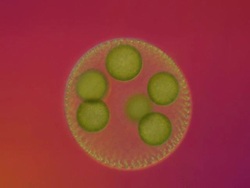 Volvox colony with daughter colonies; composed of hundreds of green algae cells each with 2 whip like flagellae and a red eye spot. Stock Footage