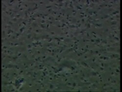 Microscopic, Salmonella typhimureum bacteria Stock Footage