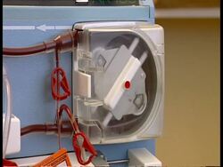 CU Dialysis machine pumping blood Stock Footage