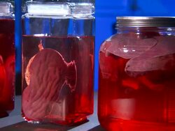 Medium_pan-left zoom-out - Glass jars hold human organs suspended in liquid.   Stock Footage