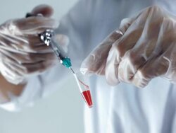 Blood Sample Stock Footage