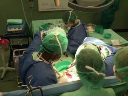 open-heart sergery, doctors around the operated child, in wolfson hospital. Save A Child''s Heart project. Stock Footage