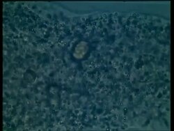 BCU microscopic view of Amoeba moving Stock Footage