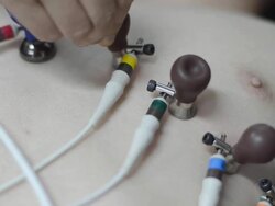 ECG chest electrode Stock Footage