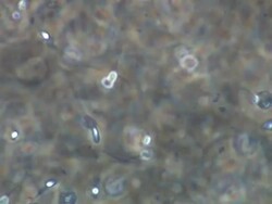 Human sperm, lots swimming around, locked off Stock Footage