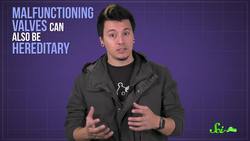 Why Do I Have Varicose Veins? Instructional Video