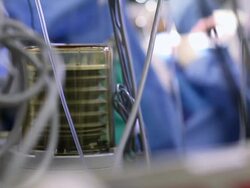 Doctors performing a surgery Stock Footage