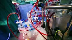 Blood motion through cardiopulmonary bypass Stock Footage