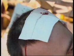 TURKEY: EARTHQUAKE DISASTER: PUBLIC HEALTH WORRIES (2) News Clip