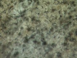 Long track across network of blood capillaries in tadpole tail.  Differential Interference Contrast. Shutter speed 1/1000 second. Olympus S-Plan 10x objective and NFK 3.3x photoeyepice. Horizontal field of view 500 micrometres. Stock Footage