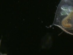 Endoscope view of Water fleas (Daphnia sp.) Sony PMW-EX3 Full HD video camera with endoscope, horizontal field of view is 3mm and slow motion at 60 fps. Stock Footage