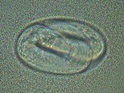 Caenorhabditis elegans egg with embryo moving inside, surrounded by bacterial suspension (E.coli OP50). Stock Footage