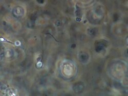 Single Human sperm swimming, noisy background, Phase contrast Stock Footage