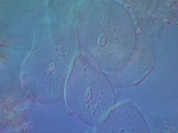 Human epithelial cells from Human tongue scrape.  Nomarski Differential Interference Contrast, horizontal field of view 100 micrometres. Stock Footage