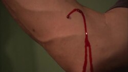 Blood flows from a bat bite on a man's elbow. Stock Footage