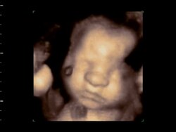 Close up on Foetus face, 4D ultrasound.. Stock Footage