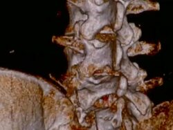 ECU CT scan of human spinal cord and ileum / Vermont, USA Stock Footage