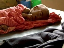 Undernourished child lying Stock Footage