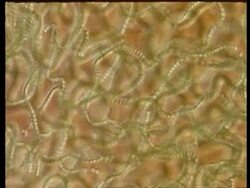 CU microscopic view of Blue green algae pull focus Stock Footage