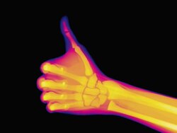 Thumbs up, coloured X-ray Stock Footage