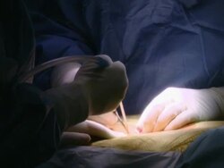 CU Two surgeons operating and assisting each other / Cagliari, Sardinia, Italy Stock Footage
