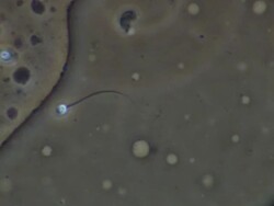 Human sperm swimming, close up, Phase contrast Stock Footage