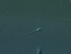 Single Human sperm swimming, Interference contrast Stock Footage