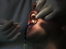 Dentist at work Stock Footage