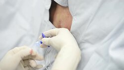 Anasthesiologist apply Epidural Catheter Stock Footage