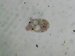 Microbe dying Stock Footage