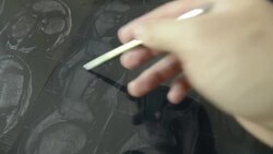 Doctor reading MRI film result Stock Footage