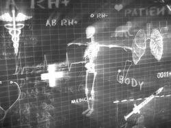 Medical Chalkboard Writing Stock Footage