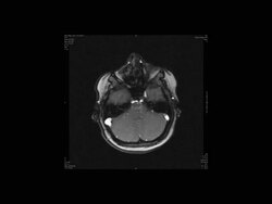 Human brain, magnetic resonance imaging (MRI) scan Stock Footage