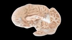 Seeing Beyond The Visual Cortex Instructional Video