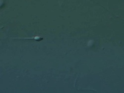Single Human sperm swimming, Interference contrast Stock Footage