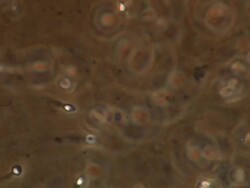 Human sperm, lots swimming around, red brown background Stock Footage