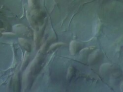 Capillaries of Toad tadpole tail.  Olympus BH-2 microscope Olympus S-Plan 20x objective with 5x photoeyepiece. Differential Interference Contrast. Shutter speed 1/1000 second. Horizontal field of view 340 micrometres.  Changing focus Stock Footage